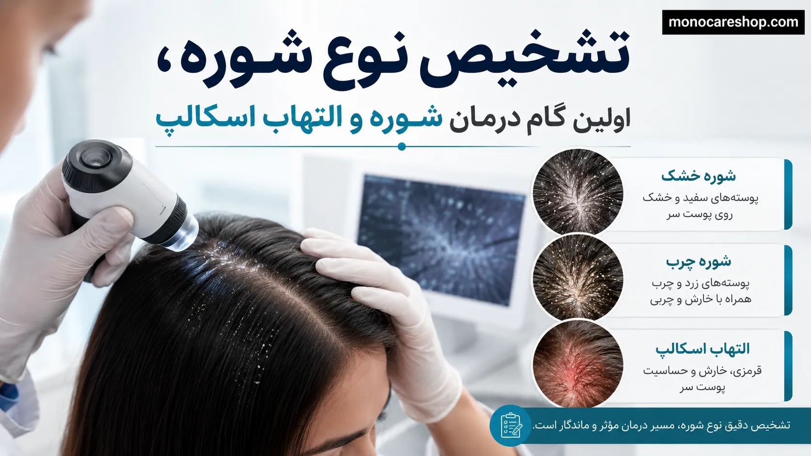 تشخیص نوع شوره، اولین گام درمان شوره و التهاب اسکالپ