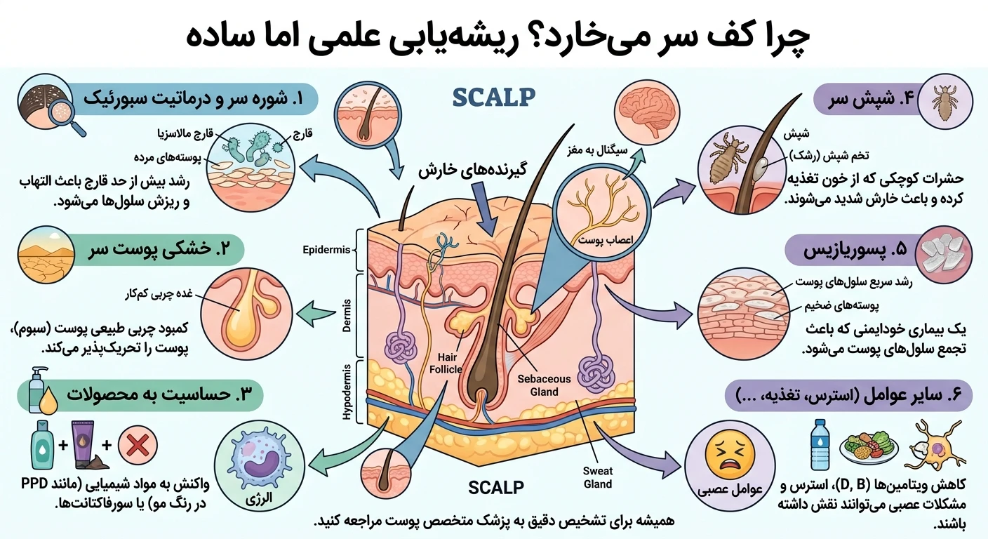 چرا کف سر میخارد؟ ریشهیابی علمی اما ساده