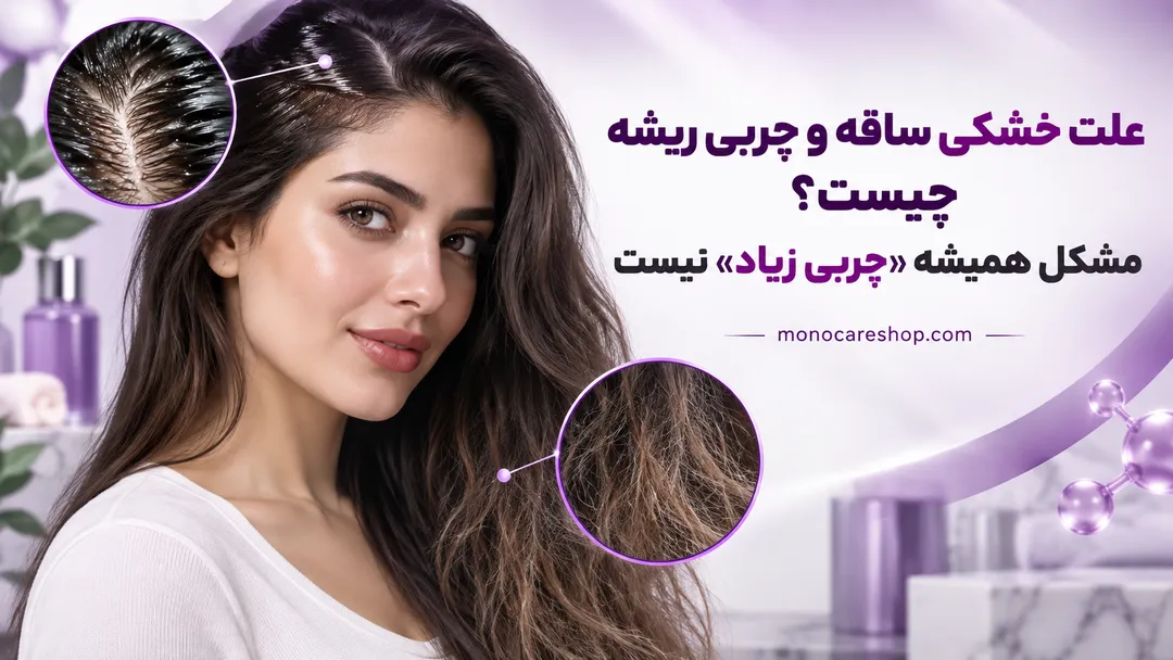 علت خشکی ساقه و چربی ریشه چیست؟ مشکل همیشه «چربی زیاد» نیست