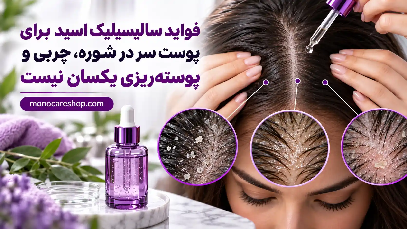 فواید سالیسیلیک اسید برای پوست سر در شوره، چربی و پوستهریزی یکسان نیست