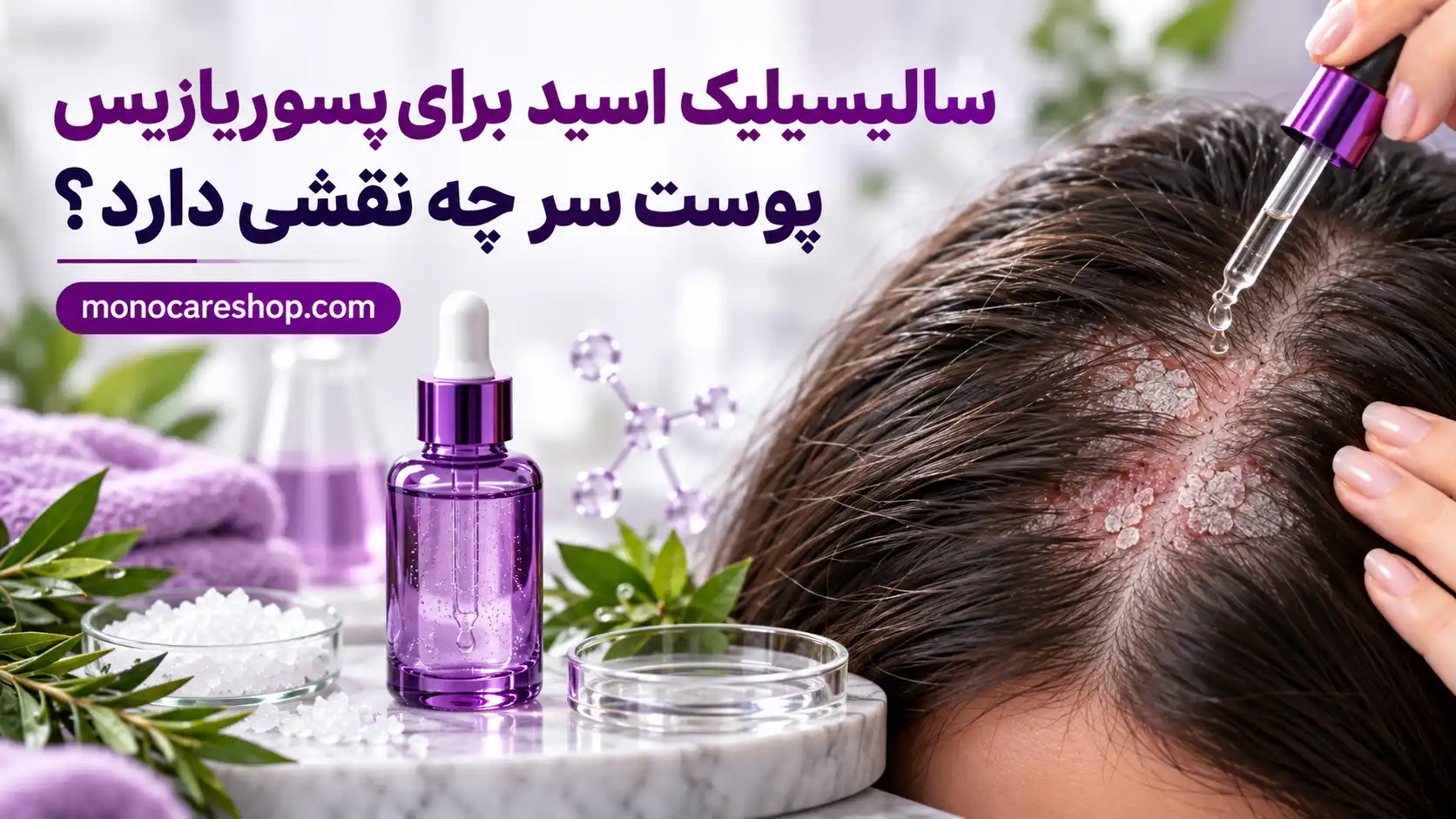 سالیسیلیک اسید برای پسوریازیس پوست سر چه نقشی دارد؟