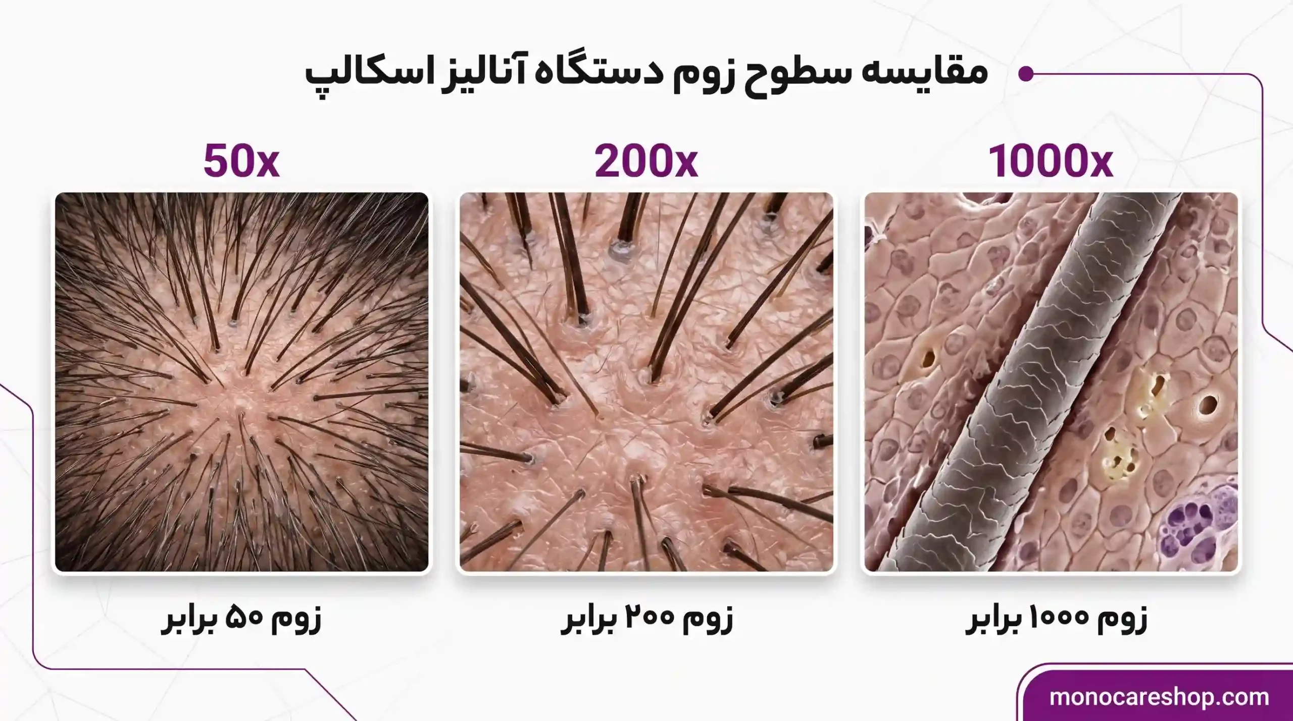 فرق زوم های مختلف دستگاه آنالیز اسکالپ؛ مقایسه ۳ سطح زوم ۵۰، ۲۰۰ و ۱۰۰۰ برابر