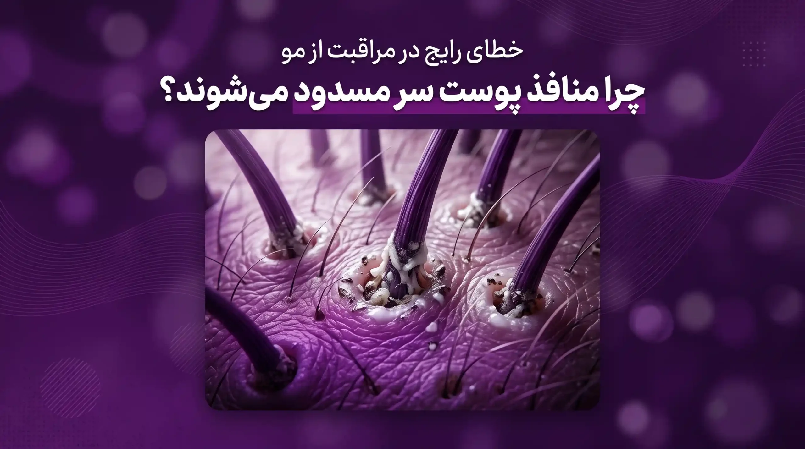 خطای رایج در مراقبت از مو: چرا منافذ پوست سر مسدود میشوند؟
