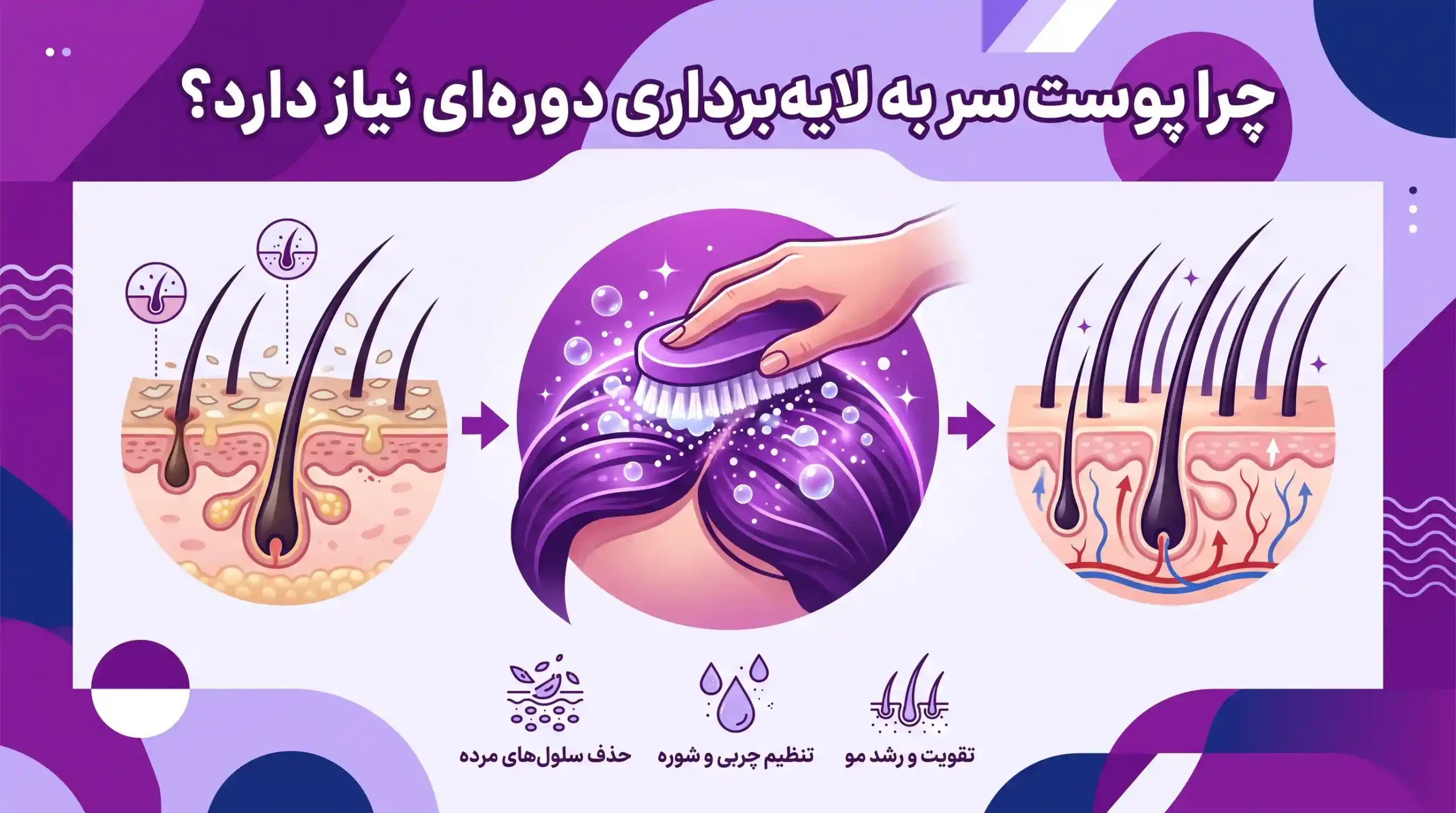 چرا پوست سر به لایهبرداری دورهای نیاز دارد؟