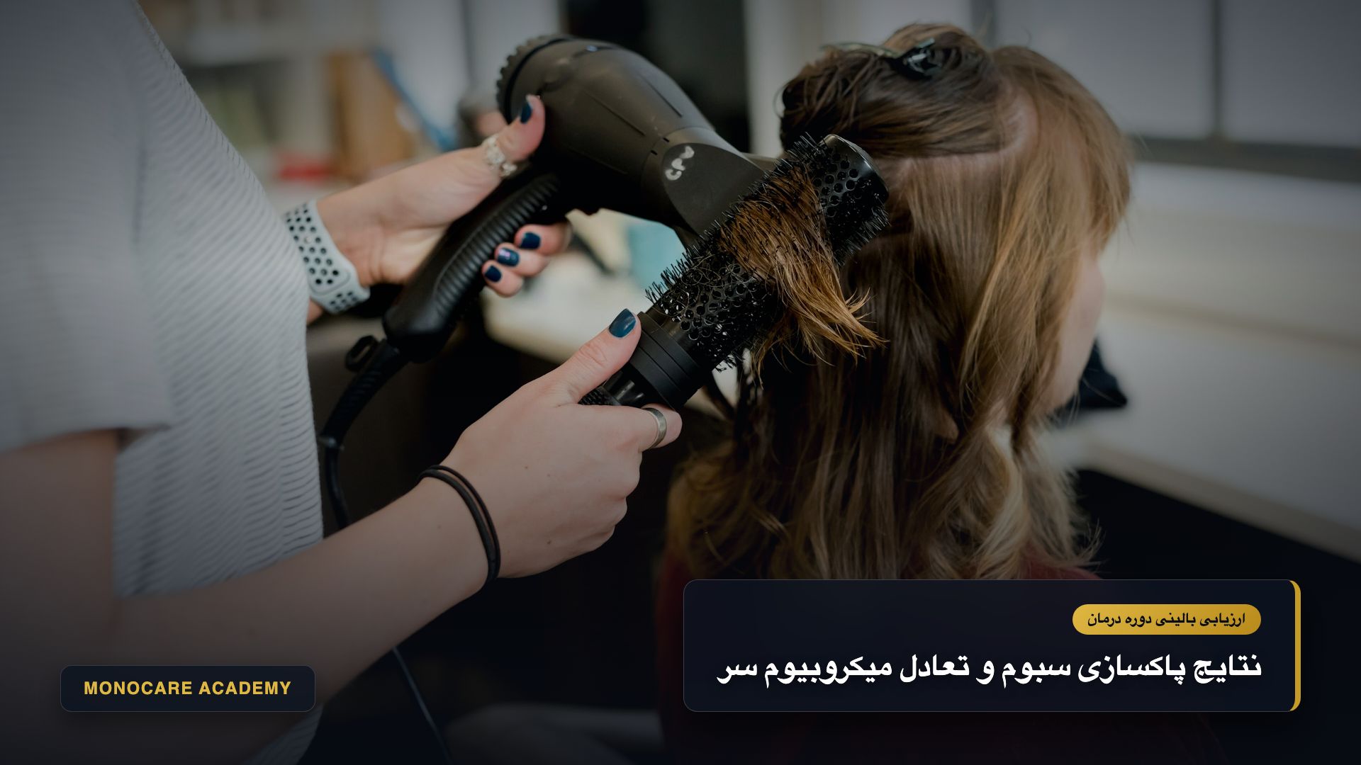 نتایج قبل و بعد دوره درمانی اکسیر مونوکر در پاکسازی سبوم اکسیدشده و مهار شوره سر