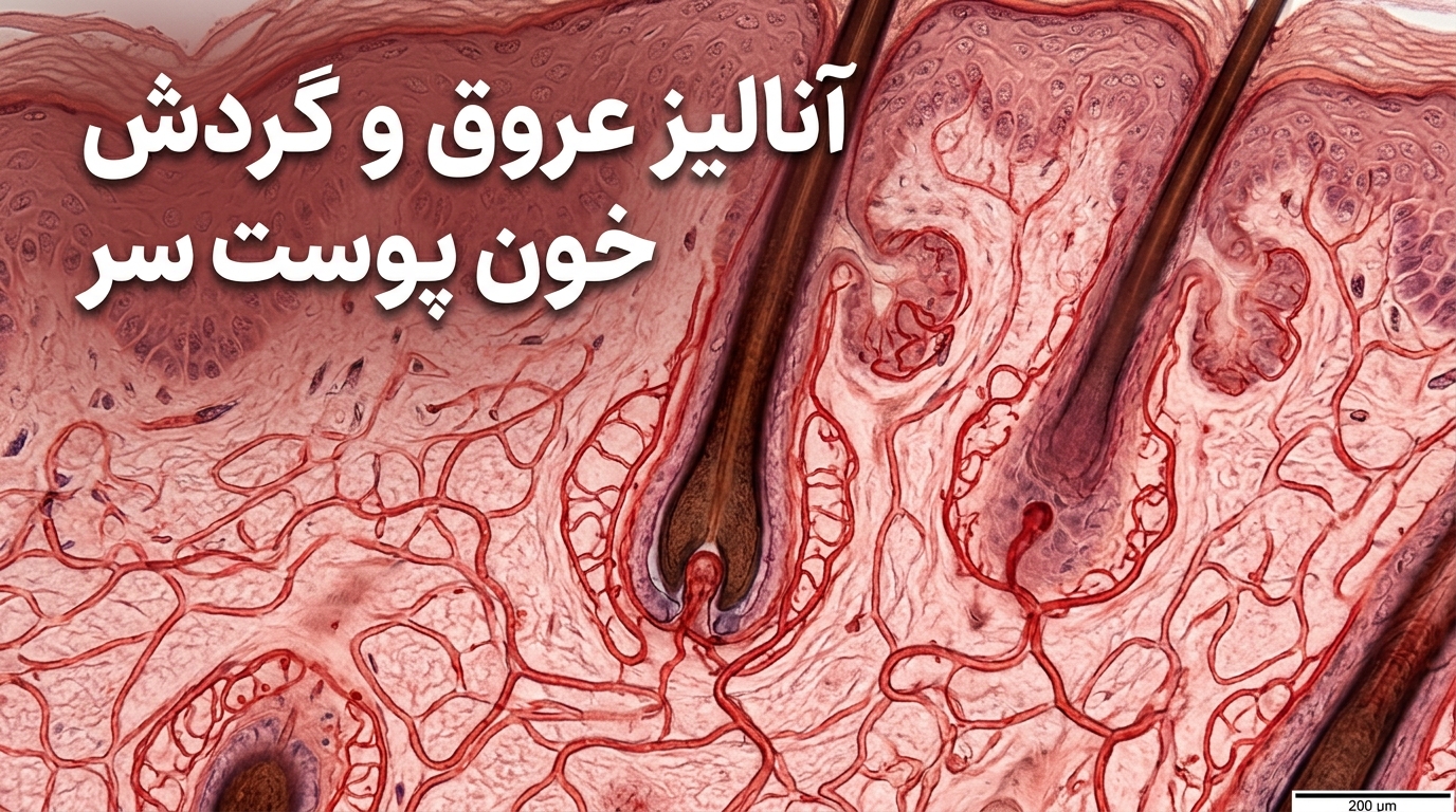 الگوی عروق مویرگی و شبکه خونرسانی ریزاطراف پیاز مو در بافتشناسی و اسکن تخصصی